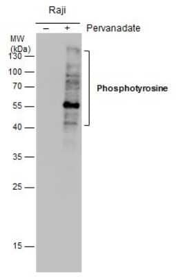 Western Blot: Phospho-Tyrosine Antibody (21) [NBP2-42911] - Analysis of Un-treated (-) and treated (+), 1mM Pervanadate treatment for 30min. Raji whole cell extracts (5 ug) were separated by 12% SDS-PAGE, and the membrane was blotted with Phosphotyrosine antibody.