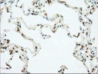 Immunohistochemistry-Paraffin: Phosphodiesterase 4A/PDE4A Antibody (1C8) [NBP2-02559] - Staining of paraffin-embedded Human lung tissue using anti-PDE4A mouse monoclonal antibody.