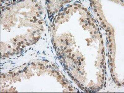 Immunohistochemistry-Paraffin: Phosphodiesterase 4A/PDE4A Antibody (1C8) [NBP2-02559] - Staining of paraffin-embedded Human prostate tissue using anti-PDE4A mouse monoclonal antibody.