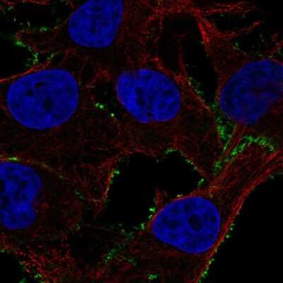 Immunocytochemistry/Immunofluorescence: Phosphodiesterase 4A/PDE4A Antibody [NBP2-55923] - Staining of human cell line SK-MEL-30 shows localization to plasma membrane.