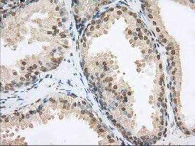 Immunohistochemistry: Phosphodiesterase 4A/PDE4A Antibody (OTI1C8) - Azide and BSA Free [NBP2-73376] - Staining of paraffin-embedded Human prostate tissue using anti-PDE4A mouse monoclonal antibody.