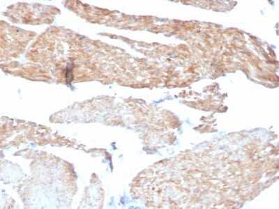Immunohistochemistry-Paraffin Phosphoglucomutase 5 Antibody (14F8/F8) - Azide and BSA Free