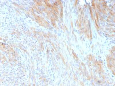 Immunohistochemistry-Paraffin: Phosphoglucomutase 5 Antibody (14F8/F8) - Azide and BSA Free [NBP3-08656] - Formalin-fixed, paraffin-embedded human uterus stained with Phosphoglucomutase 5 Mouse Monoclonal Antibody (14F8/F8).