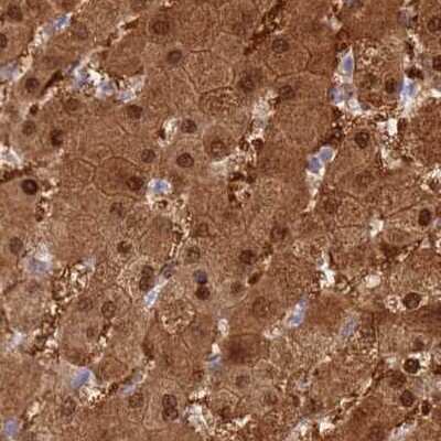 Immunohistochemistry: Phosphoglucomutase 5 Antibody [NBP2-32043] - Staining of liver.