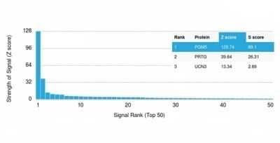 Protein Array: Phosphoglucomutase 5 Antibody (PGM5/3552) [NBP3-13996] - Analysis of Protein Array containing more than 19,000 full-length human proteins using Phosphoglucomutase 5 Antibody (PGM5/3552).