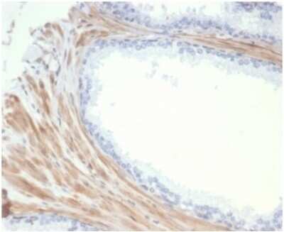 Immunohistochemistry-Paraffin: Phosphoglucomutase 5 Antibody (PGM5/7005R) [NBP3-13731] - Formalin-fixed, paraffin-embedded human tonsil prostate with Phosphoglucomutase 5 antibody (PGM5/7005R) at 2ug/ml. HIER: Tris/EDTA, pH9.0, 45min. HRP-polymer, 30min. DAB, 5min.