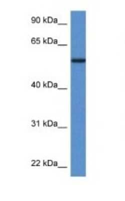 Western Blot: Phosphoglucomutase 5 Antibody [NBP1-74091] - Titration: 1.0 ug/ml Positive Control: Fetal Heart.
