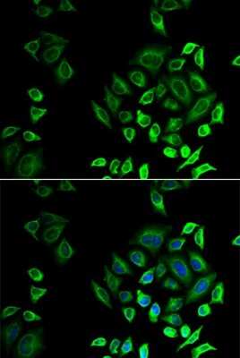 Immunocytochemistry/Immunofluorescence: Phospholipase A2 IID Antibody [NBP2-93007] - Analysis of U2OS cells using Phospholipase A2 IID . Blue: DAPI for nuclear staining.