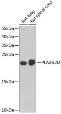 Western Blot: Phospholipase A2 IID Antibody [NBP2-93007] - Analysis of extracts of various cell lines, using Phospholipase A2 IID at 1:1000 dilution. Secondary antibody: HRP Goat Anti-Rabbit IgG (H+L) at 1:10000 dilution. Lysates/proteins: 25ug per lane. Blocking buffer: 3% nonfat dry milk in TBST. Detection: ECL Basic Kit . Exposure time: 90s.