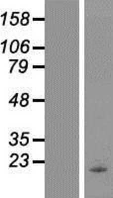 Western Blot: Phospholipase A2 IID Overexpression Lysate (Adult Normal) [NBP2-10352] Left-Empty vector transfected control cell lysate (HEK293 cell lysate); Right -Over-expression Lysate for Phospholipase A2 IID.