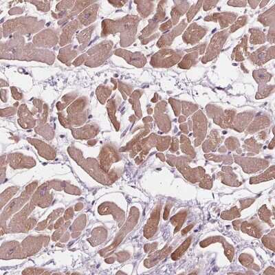 Immunohistochemistry-Paraffin Phospholipase A2 IIE Antibody - BSA Free