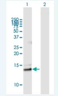 Western Blot Phospholipase A2 IIE Antibody - Azide and BSA Free