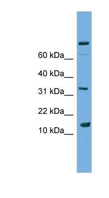 Western Blot: Phospholipase A2 IIE Antibody [NBP1-79199] - Jurkat cell lysate, concentration 0.2-1 ug/ml.