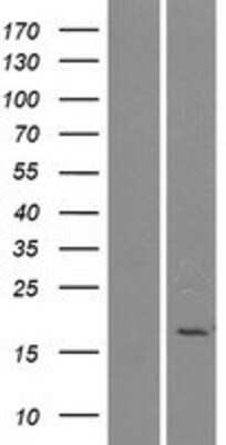 Western Blot: Phospholipase A2 IIE Overexpression Lysate (Adult Normal) [NBP2-10315] Left-Empty vector transfected control cell lysate (HEK293 cell lysate); Right -Over-expression Lysate for Phospholipase A2 IIE.
