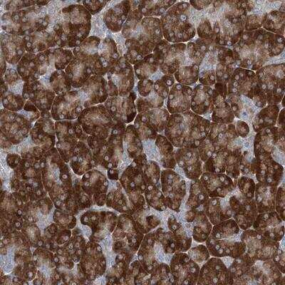 Immunohistochemistry: Phospholipase A2 XII Antibody [NBP1-87265] - Staining of human pancreas shows strong cytoplasmic positivity in exocrine glandular cells.