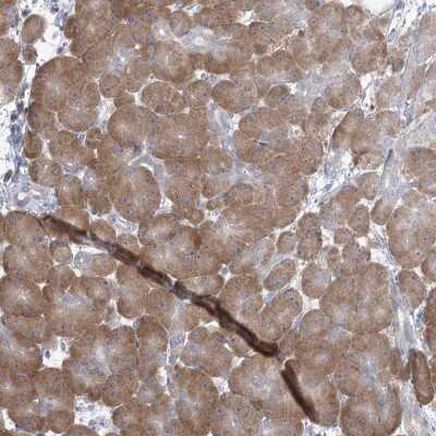 Immunohistochemistry: Phospholipase A2 XII Antibody [NBP2-38272] - Staining of human pancreas shows moderate cytoplasmic positivity in exocrine glandular cells.
