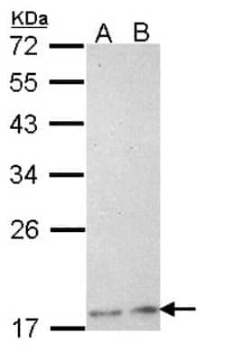 Western Blot: Phospholipase A2 XII Antibody [NBP1-31693] - Sample (30 ug of whole cell lysate) A: H1299 B: Hela 12% SDS PAGE; antibody diluted at 1:1000.