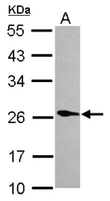 Western Blot: Phospholipase A2 XII Antibody [NBP2-19808] - Sample (30 ug of whole cell lysate) A: HeLa 12% SDS PAGE gel, diluted at 1:1000.