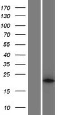 Western Blot: Phospholipase A2 XII Overexpression Lysate (Adult Normal) [NBP2-06175] Left-Empty vector transfected control cell lysate (HEK293 cell lysate); Right -Over-expression Lysate for Phospholipase A2 XII.