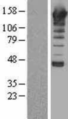 Western Blot PLC-beta 1 Overexpression Lysate