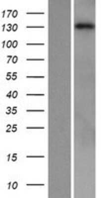 Western Blot PLC-beta 1 Overexpression Lysate