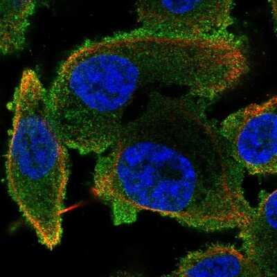 Immunocytochemistry/Immunofluorescence: Phospholipase C beta 2 Antibody [NBP2-58951] - Staining of human cell line PC-3 shows localization to cytosol.