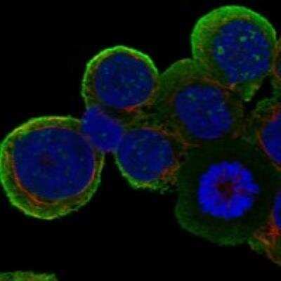 Immunocytochemistry/Immunofluorescence: Phospholipase C beta 2 Antibody [NBP3-17086] - Staining of human cell line HEL shows localization to nucleoli & plasma membrane.