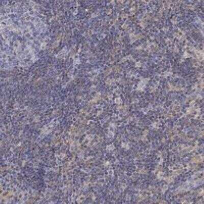 Immunohistochemistry-Paraffin: Phospholipase C beta 2 Antibody [NBP3-17086] - Staining of human lymph node shows weak cytoplasmic positivity in non-germinal center cells.