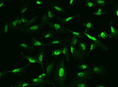 Immunocytochemistry/Immunofluorescence: Phospholipase C delta 1 Antibody [NBP3-05935] - Staining of PLCD1 in U251MG cells. Cells were fixed with 4% PFA, permeabilzed with 0.1% Triton X-100 in PBS,blocked with 10% serum, and incubated with rabbit anti-Human PLCD1 polyclonal antibody (dilution ratio 1:200) at 4? overnight. Then cells were stained with the Alexa Fluor®488-conjugated Goat Anti-rabbit IgG secondary antibody (green). Positive staining was localized to Nucleus.