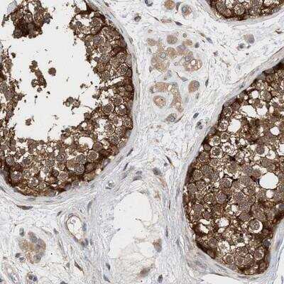 Immunohistochemistry: Phospholipase C delta 1 Antibody [NBP1-87557] - Staining of human testis shows cytoplasmic positivity in cells in seminiferus ducts.