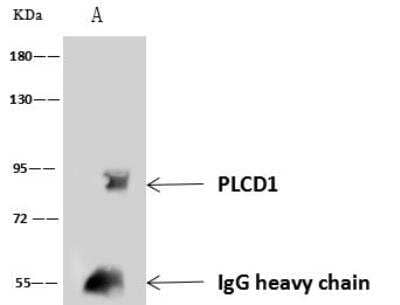 Immunoprecipitation: Phospholipase C delta 1 Antibody [NBP3-05935] - Lane A:0.5 mg NIH3T3 Whole Cell Lysate4 uL anti-PLCD1 rabbit polyclonal antibody and 60 ug of Immunomagnetic beads Protein A/G.Primary antibody:Anti-PLCD1 rabbit polyclonal antibody,at 1:100 dilution Secondary antibody:Goat Anti-Rabbit IgG (H+L)/HRP at 1/10000 dilutionDeveloped using the ECL technique.Performed under reducing conditions.Predicted band size: 86 kDaObserved band size :90 kDa