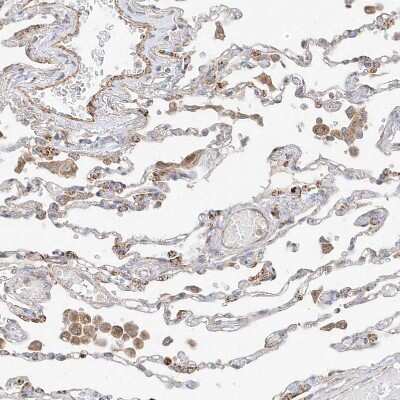 Immunohistochemistry-Paraffin: Phospholipase C like 1 Antibody [NBP1-80896] - Staining of human lung shows weak to moderate cytoplasmic positivity in pneumocytes and in macrophages.