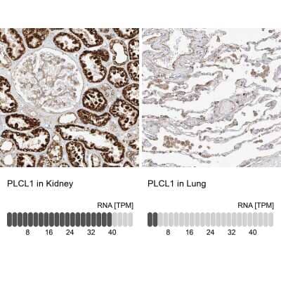 Immunohistochemistry-Paraffin: Phospholipase C like 1 Antibody [NBP1-80896] - Staining in human kidney and lung tissues . Corresponding PLCL1 RNA-seq data are presented for the same tissues.