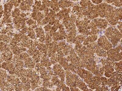 Immunohistochemistry-Paraffin: Phospholipase C like 1 Antibody [NBP3-06275] - Immunochemical staining of human Phospholipase C like 1 in human adrenal gland with rabbit polyclonal antibody at 1:1000 dilution, formalin-fixed paraffin embedded sections.