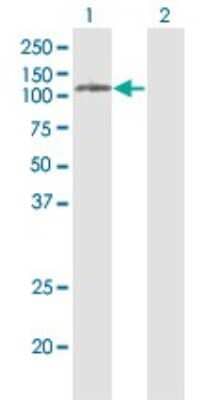 Western Blot Phospholipase D2 Antibody (1C5)