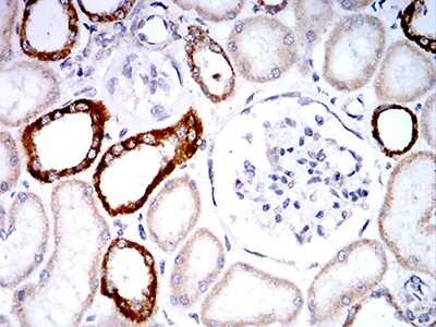 Immunohistochemistry: Phospholipase D2 Antibody (7E4D9) [NBP2-61784] - Analysis of paraffin-embedded renal tissues using PLD2 mouse mAb with DAB staining.