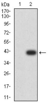 Western Blot: Phospholipase D2 Antibody (7E4D9) [NBP2-61784] - Analysis using PLD2 mAb against HEK293 (1) and PLD2 (AA: 834-933)-hIgGFc transfected HEK293 (2) cell lysate.