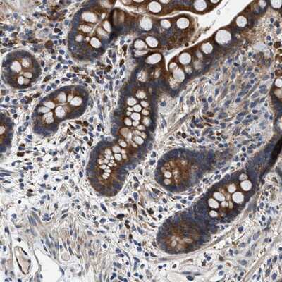 Immunohistochemistry-Paraffin: Phospholipase D2 Antibody [NBP1-87576] - Staining of human colon shows strong cytoplasmic positivity in glandular cells.