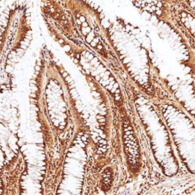 Immunohistochemistry-Paraffin Phospholipase D2 Antibody