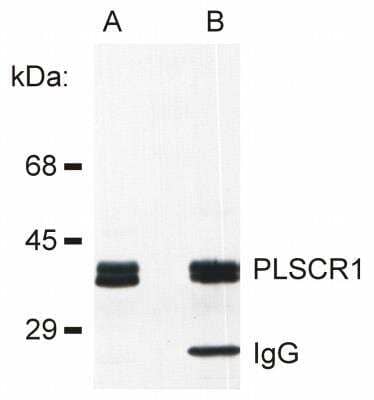 Western Blot: Phospholipid Scramblase 1/PLSCR1 Antibody (13A6 [TEC-23]) [NBP2-62189] - Detection of PLSCR1 in rat basophilic leukemia (RBL) cell line lysate (A) and in PLSCR1 immunoprecipitate from RBL lysate (B). The antibody 13A6 (Tec-23) was used both for immunoprecipitation and immunodetection.