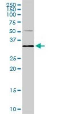 Western Blot: Phospholipid Scramblase 1/PLSCR1 Antibody (1E11) [H00005359-M12] - Analysis of PLSCR1 expression in human pancreas.