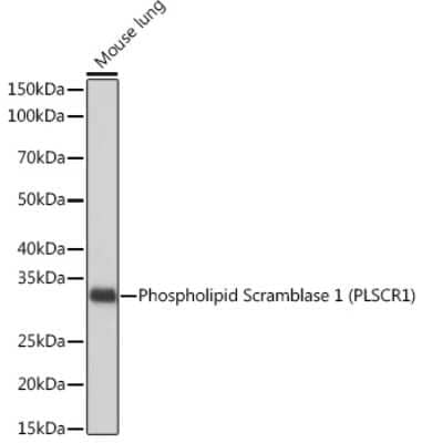 Western Blot: Phospholipid Scramblase 1/PLSCR1 Antibody (5U6G1) [NBP3-16183] - Western blot analysis of extracts of Mouse lung, using Phospholipid Phospholipid Scramblase 1/PLSCR1 (PLSCR1) Rabbit mAb (NBP3-16183) at 1:1000 dilution. Secondary antibody: HRP Goat Anti-Rabbit IgG (H+L) at 1:10000 dilution. Lysates/proteins: 25ug per lane. Blocking buffer: 3% nonfat dry milk in TBST. Detection: ECL Basic Kit. Exposure time: 10s.