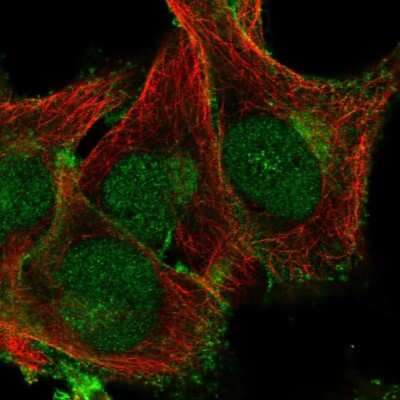 Immunocytochemistry/Immunofluorescence: Phospholipid Scramblase 1/PLSCR1 Antibody [NBP2-56521] - Staining of human cell line SK-MEL-30 shows localization to nucleus, plasma membrane & the Golgi apparatus.