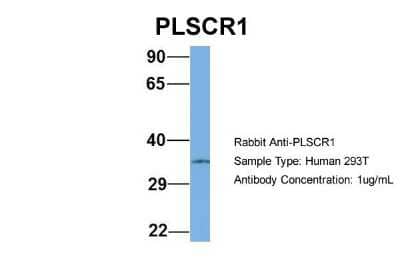Western Blot: Phospholipid Scramblase 1/PLSCR1 Antibody [NBP1-57816] - Human 293T, Antibody Dilution: 1.0 ug/ml PLSCR1 is strongly supported by BioGPS gene expression data to be expressed in Human HEK293T cells.