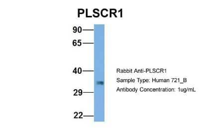 Western Blot: Phospholipid Scramblase 1/PLSCR1 Antibody [NBP1-57816] - Human 721_B, Antibody Dilution: 1.0 ug/ml PLSCR1 is supported by BioGPS gene expression data to be expressed in 721_B.