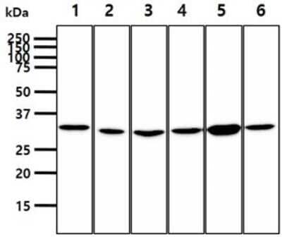 Western Blot: Phosphopantothenate-cysteine ligase Antibody (10D11) [NBP2-59481] - Lane 1: Jurkat cell lysates, Lane 2: HepG2 cell lysates, Lane 3: HeLa cell lysates, Lane 4: A549 cell lysates, Lane 5: MCF7 cell lysates, Lane 6: SK-OV-3 cell lysates