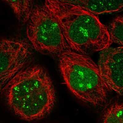 <b>Independent Antibodies Validation. </b>Immunocytochemistry/Immunofluorescence: Phosphopantothenate-cysteine ligase Antibody [NBP1-87398] - Staining of human cell line A-431 shows localization to nucleus & nucleoli fibrillar center.
