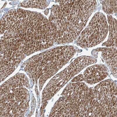 <b>Independent Antibodies Validation. </b>Immunohistochemistry: Phosphopantothenate-cysteine ligase Antibody [NBP2-38181] - Staining of human smooth muscle shows distinct cytoplasmic positivity in smooth muscle cells.