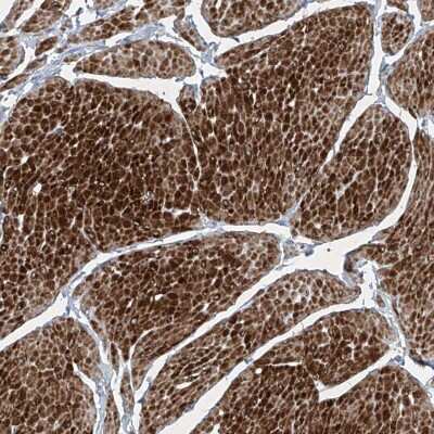 Immunohistochemistry-Paraffin: Phosphopantothenate-cysteine ligase Antibody [NBP1-87398] - Staining of human smooth muscle shows distinct cytoplasmic positivity in smooth muscle cells.