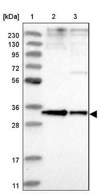 Western Blot: Phosphopantothenate-cysteine ligase Antibody [NBP1-87398] - Lane 1: Marker  [kDa] 230, 130, 95, 72, 56, 36, 28, 17, 11.  Lane 2: Human cell line RT-4.  Lane 3: Human cell line U-251MG sp